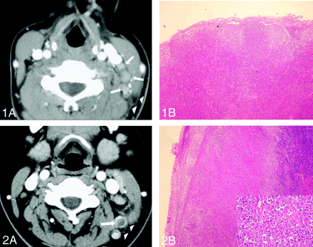 Fig 2.