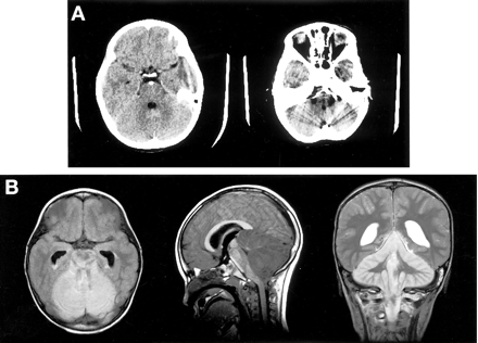 Fig 4.