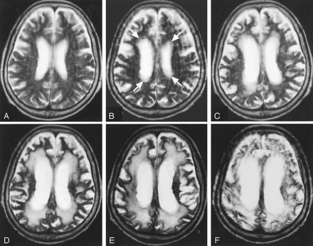Fig 2.
