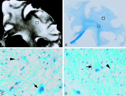 Fig 4.
