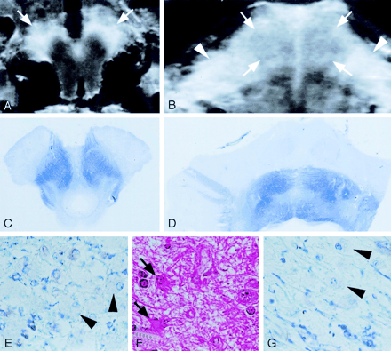 Fig 6.