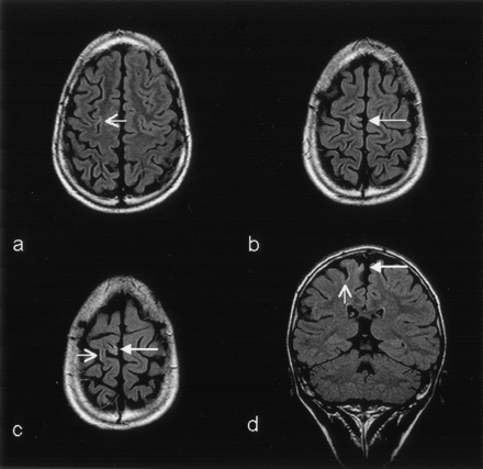 Fig 1.