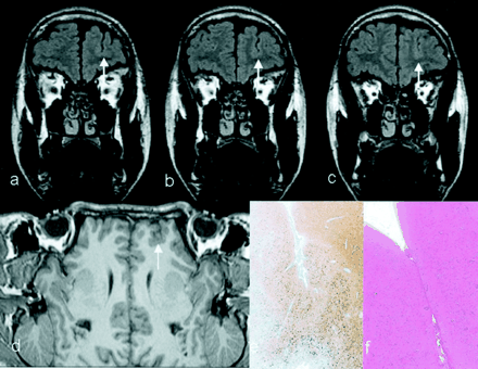 Fig 4.