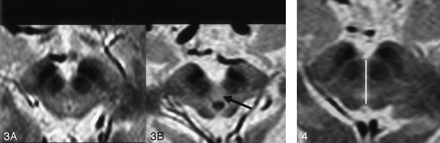Fig 3.