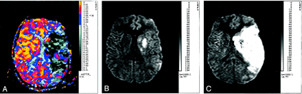 Fig 4.