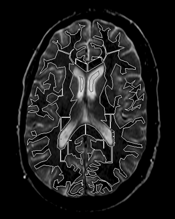Fig 1.