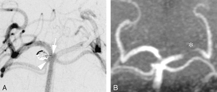 Fig 3.
