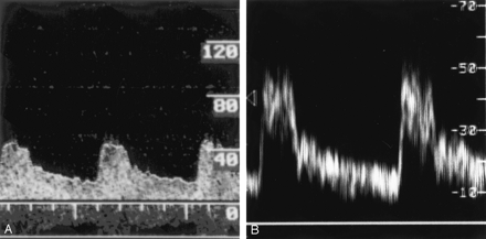 Fig 3.