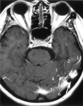 Fig 10.