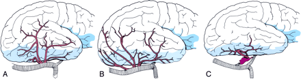 Fig 2.