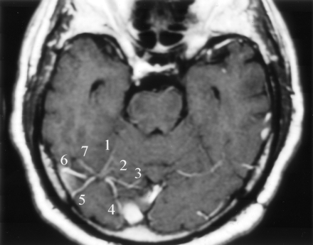 Fig 3.