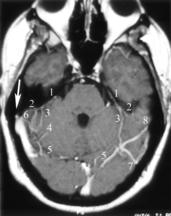 Fig 4.