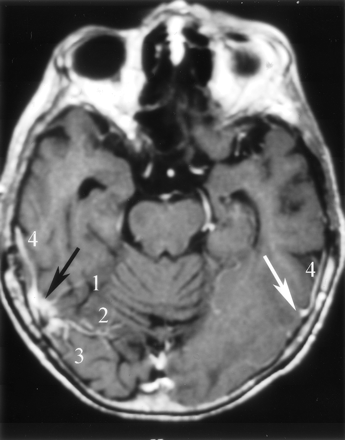 Fig 6.