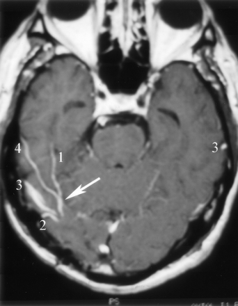 Fig 7.