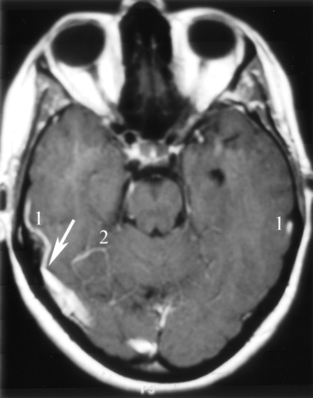 Fig 9.