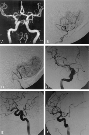 Fig 2.