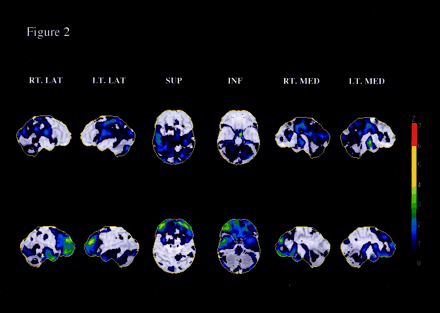 Fig 2.