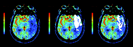 Fig 4.