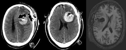 Fig 4.