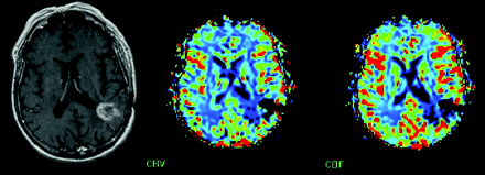 Fig 5.