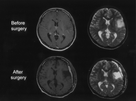 Fig 1.