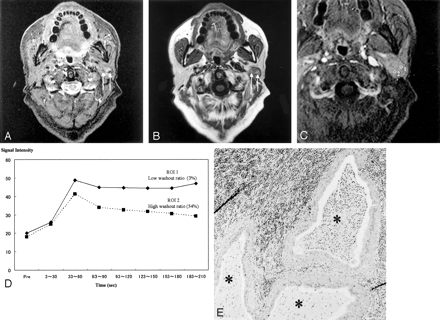 Fig 2.