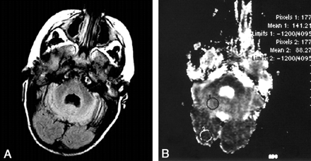 Fig 3.