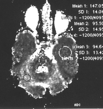 Fig 4.