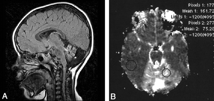 Fig 5.