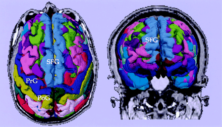 Fig 1.