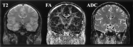 Fig 2.