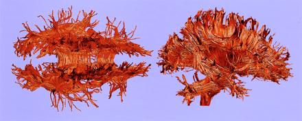 Fig 6.