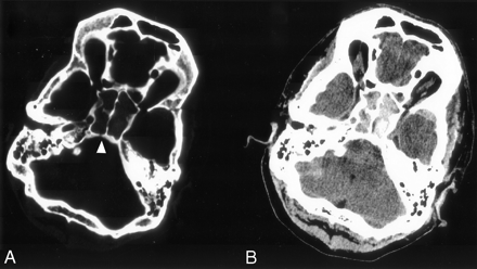 Fig 1.