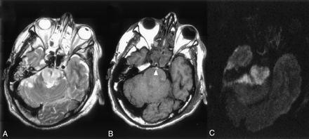Fig 2.