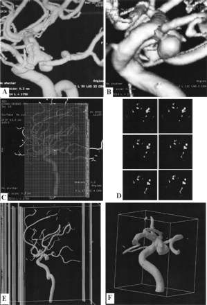 Fig 2.