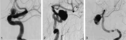 Fig 2.