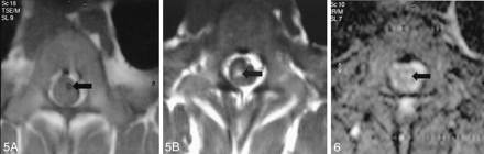 Fig 5.