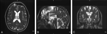 Fig 1.