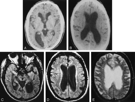 Fig 3.