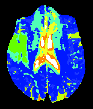 Fig 1.