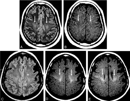 Fig 3.