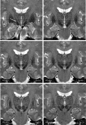 Fig 1.