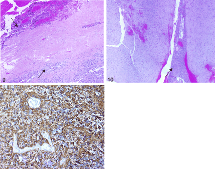 Fig 10.