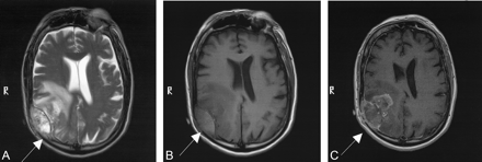 Fig 3.