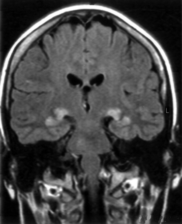 Fig 1.