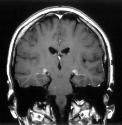 Fig 2.