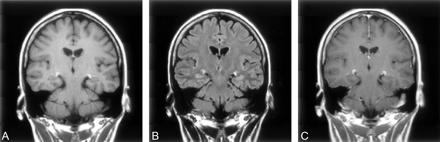 Fig 3.
