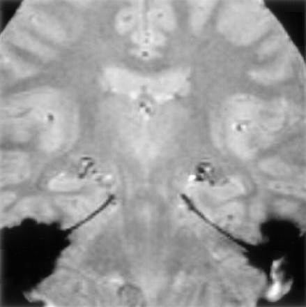 Fig 4.