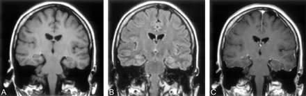 Fig 5.
