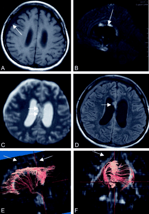 Fig 2.